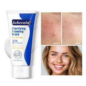 Acne Foaming Wash